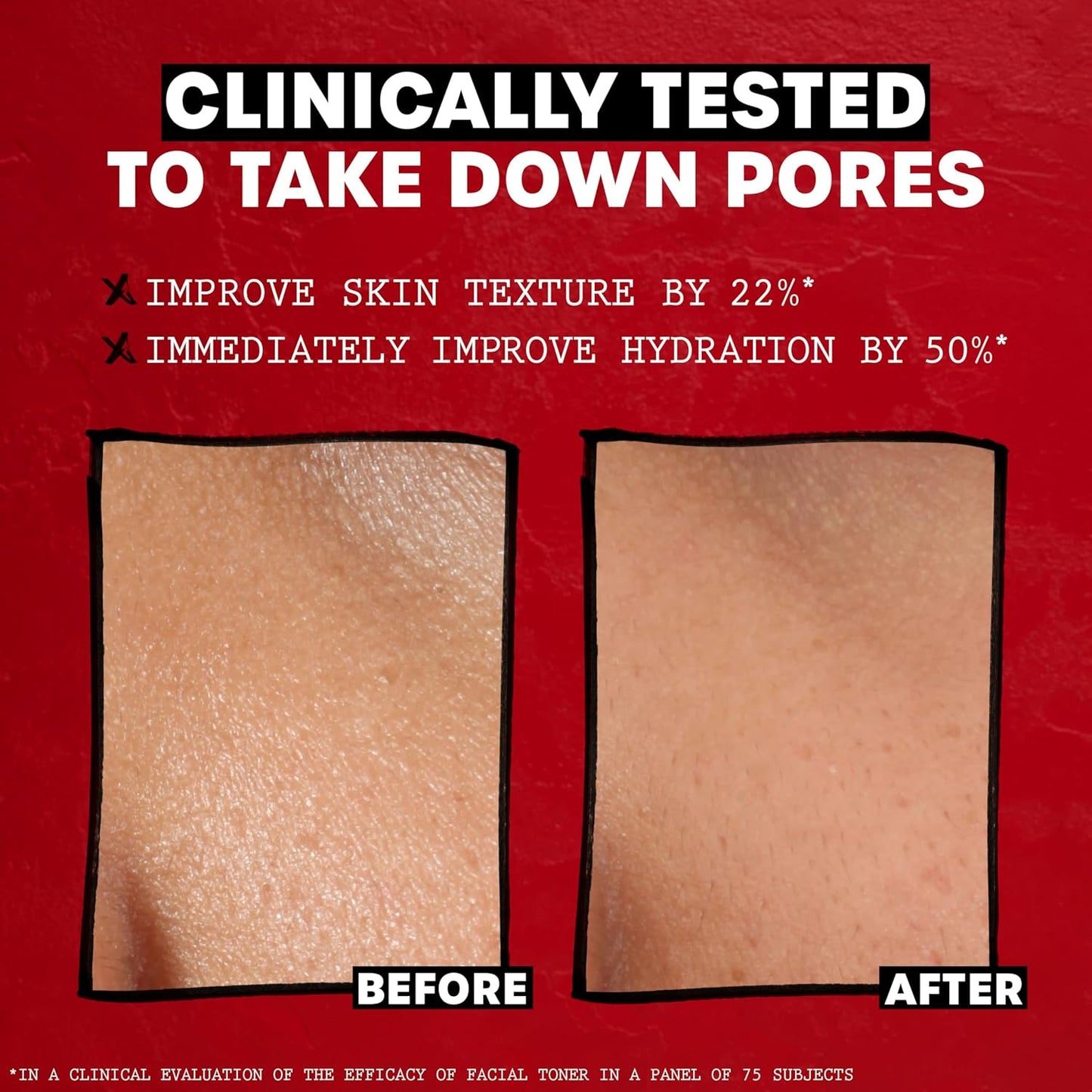 Thayers Alcohol-Free Witch Hazel Toner – Unscented, 12 oz Gentle Face Toner with Aloe Vera